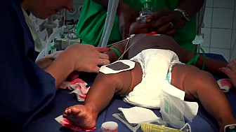 ALMOHA en mission humanitaire de chirurgie des malformations rares et congénitales à Yaoundé. (Cameroun)